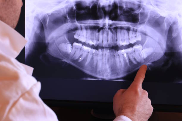 Best Emergency Root Canal Treatment in Governors Village, NC
