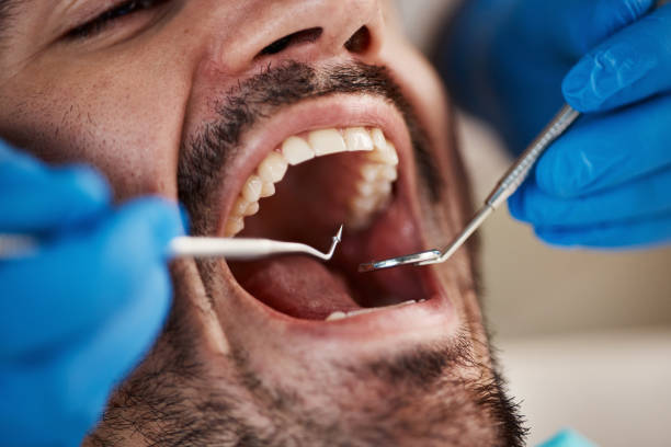 Best Weekend Emergency Dentist in Governors Village, NC